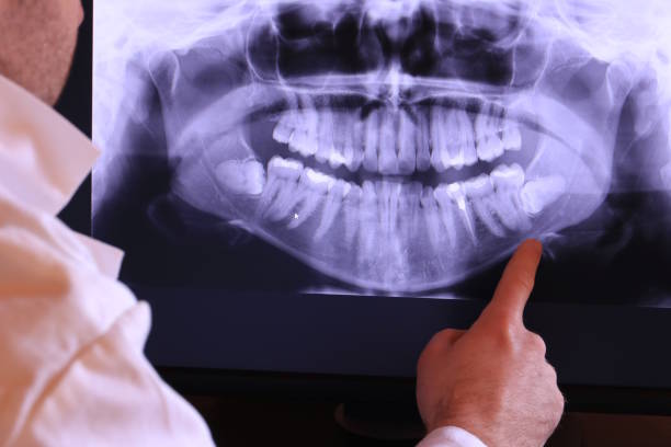 Best Broken or Chipped Tooth Repair in Oakfield, WI